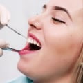 How To Choose The Right Dentist For Wisdom Teeth Removal In Gainesville, VA