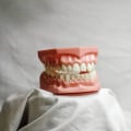 Explore Your Options for Wisdom Teeth Removal and Full Mouth Implants