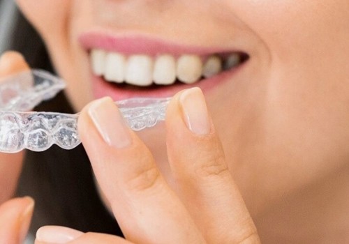 Wisdom Teeth Removal And Invisalign: A Winning Combination In Cedar Park, TX