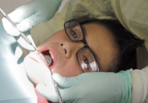 What is the Process for Wisdom Teeth Removal? - An Expert's Guide