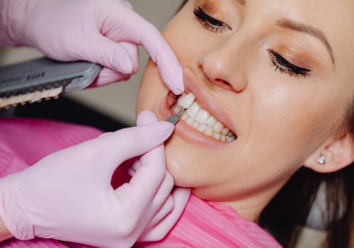 Wisdom Teeth Removal And Porcelain Veneers: A Conroe, TX Cosmetic Dentistry Pairing