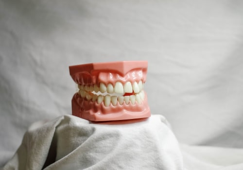 Explore Your Options for Wisdom Teeth Removal and Full Mouth Implants